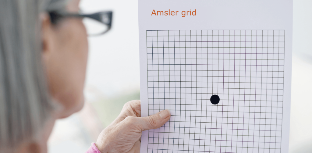 dryAMD.eu Eine Frau mit einer Lesebrille führt eigenständig den Amsler-Gitter-Test durch.