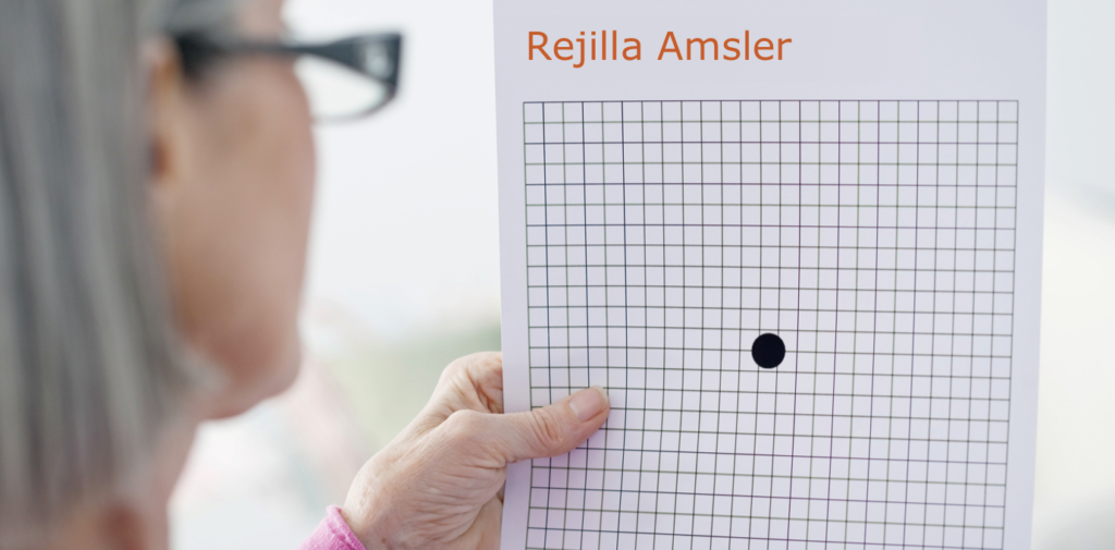 dryAMD.eu Una mujer con gafas de lectura realiza la prueba de la cuadrícula de Amsler.