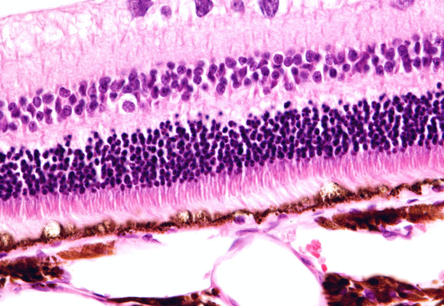 dryAMD.eu Vista dettagliata delle malattie della retina.